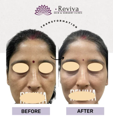 Before and after result 12